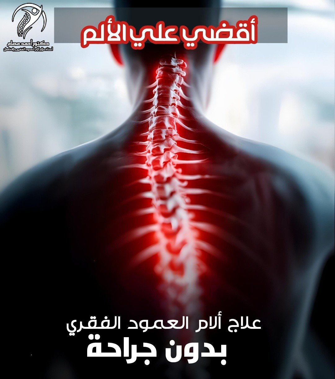 علاج الانزلاق الغضروفي بدون جراحة